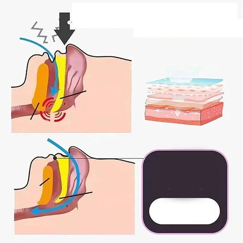 Rompiche Bande buccale anti ronflement